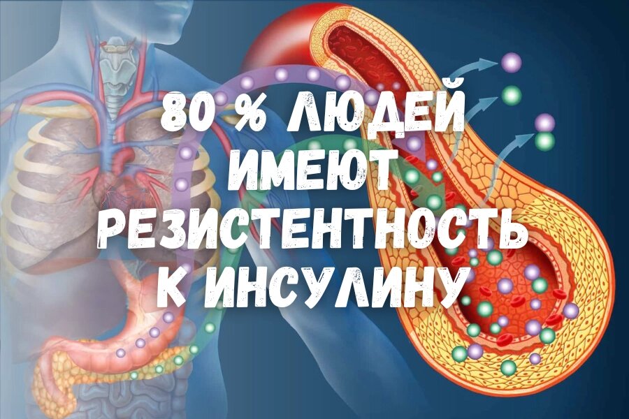 80 % людей имеют резистентность к инсулину.