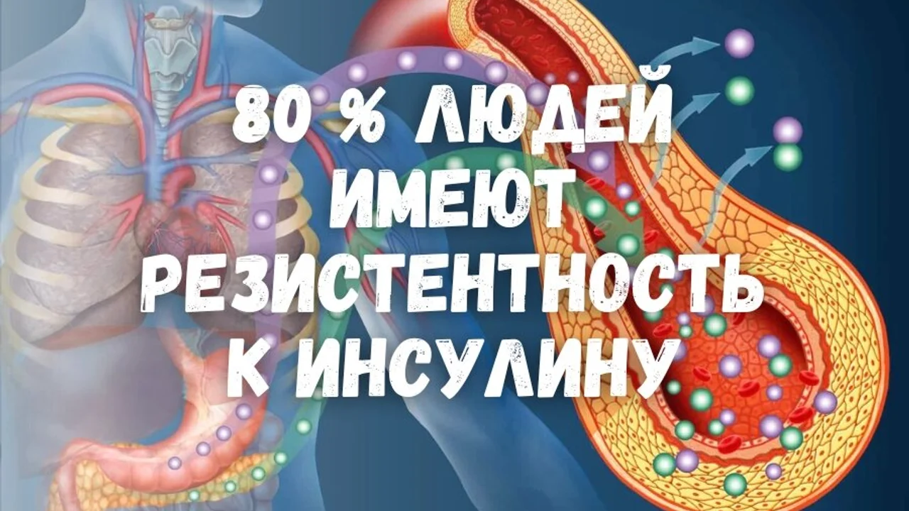 80 % людей имеют резистентность к инсулину.