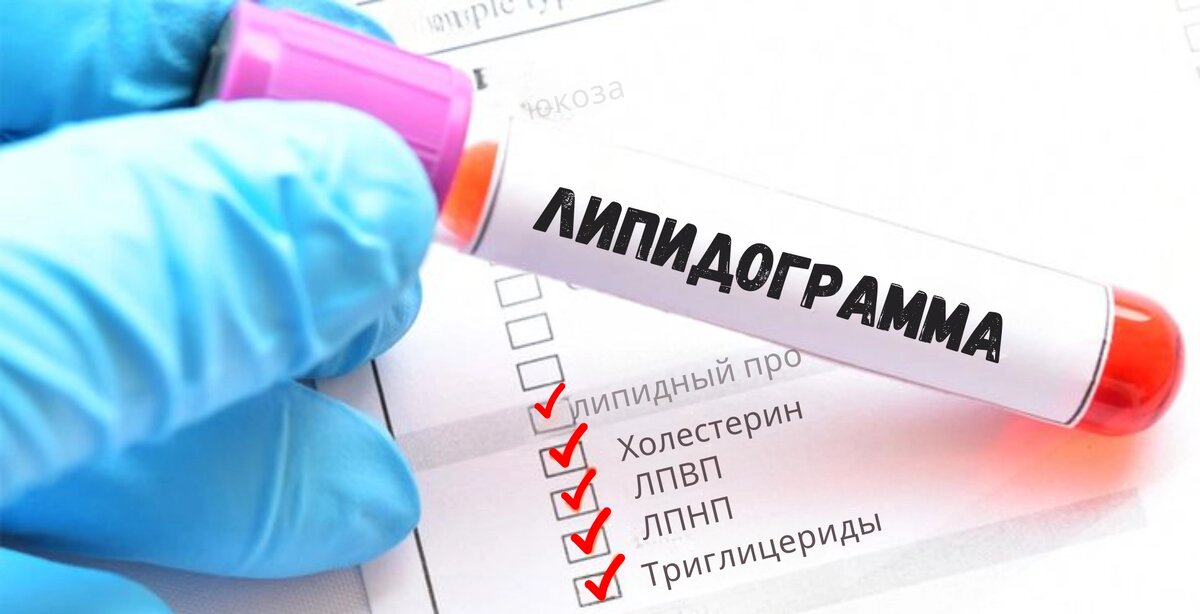 Что означают повышенные триглицериды и почему это важно