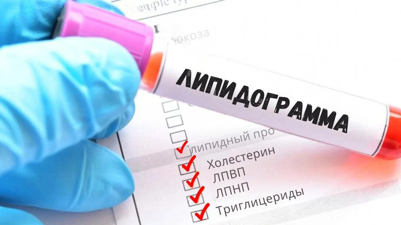 Что означают повышенные триглицериды и почему это важно