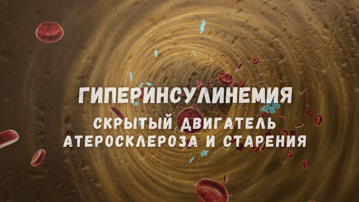 Гиперинсулинемия: скрытый двигатель атеросклероза и старения