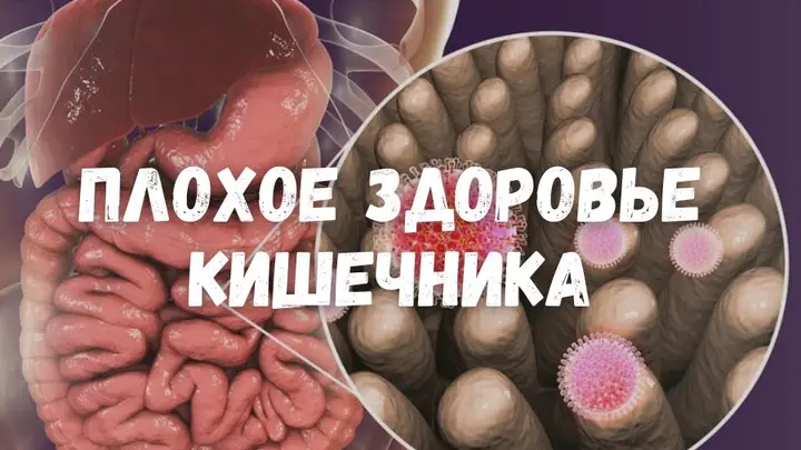 Плохое состояние кишечника