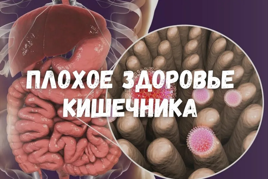 Плохое состояние кишечника