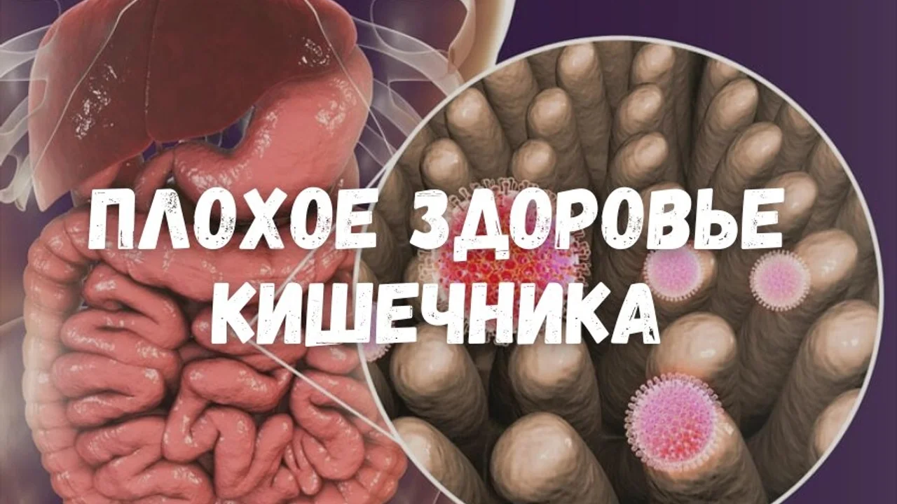 Плохое состояние кишечника