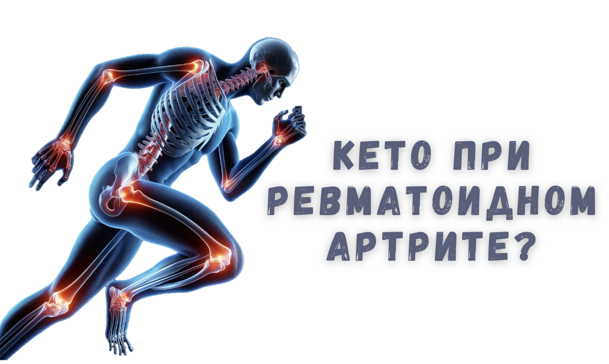 Кето при артрите