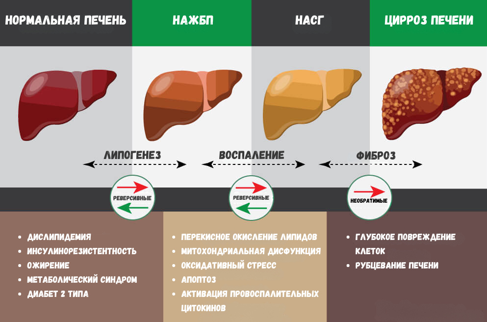 *НАЖБП (неалкогольная жировая болезнь печени) НАСГ (неалкогольный стеатогепатит)