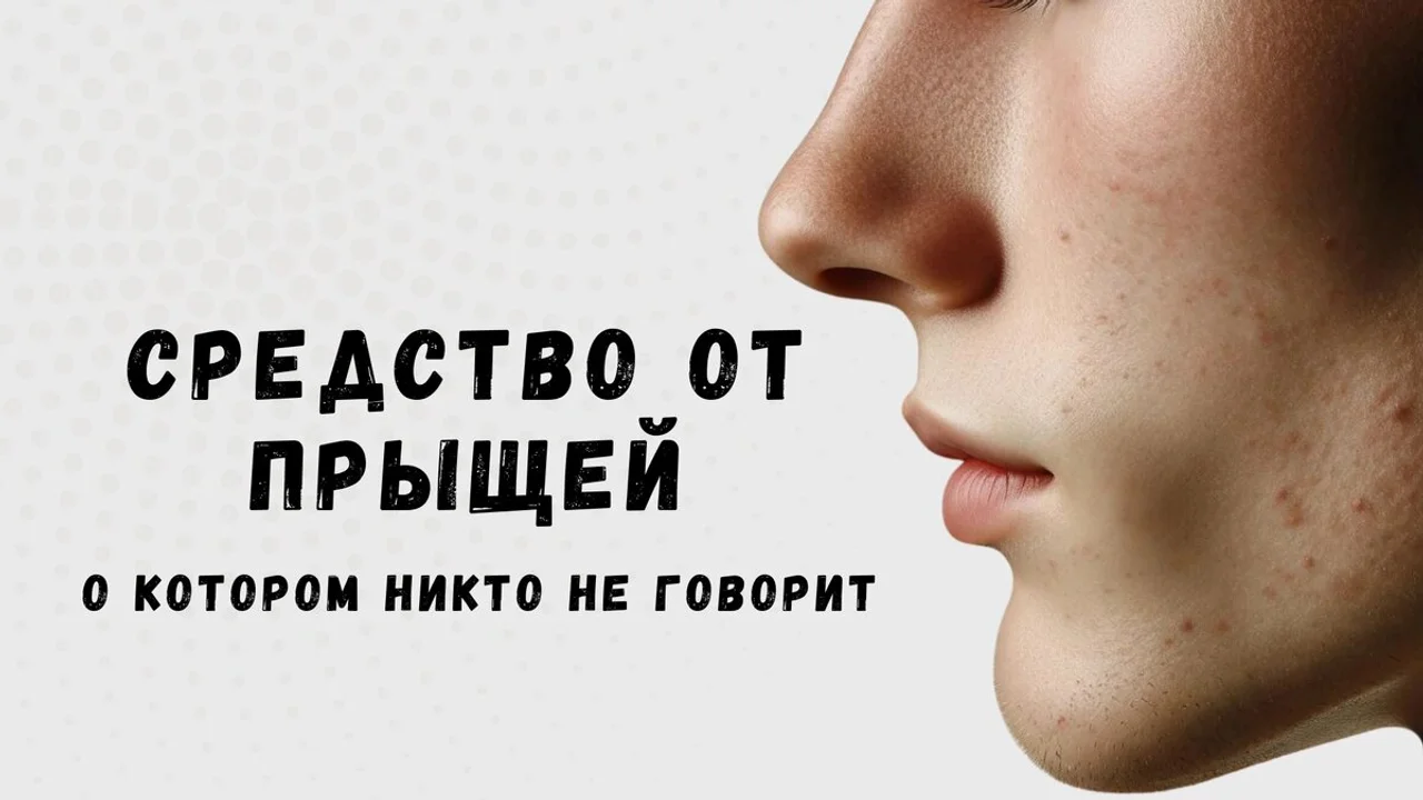 Средство от прыщей, о котором никто не говорит